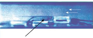 Flow reversal Image of flow reversal
