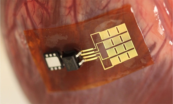 Energy-harvesting patch on a heart Image of energy-harvesting patch on a heart