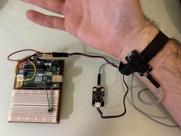 Low-Cost, Power Efficient EMG Prosthetic Hand (Part 1) Image of Low-Cost, Power Efficient EMG Prosthetic Hand (Part 1)