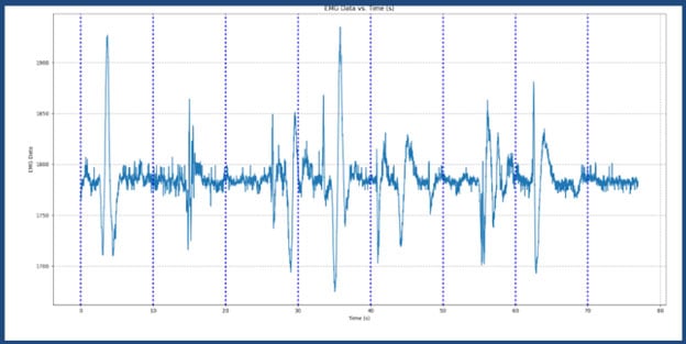 Low-Cost, Power Efficient EMG Prosthetic Hand (Part 1) Image of Low-Cost, Power Efficient EMG Prosthetic Hand (Part 1)