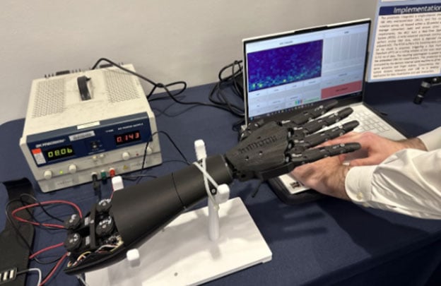 Low-Cost, Power Efficient EMG Prosthetic Hand (Part 3) Image of Low-Cost, Power Efficient EMG Prosthetic Hand (Part 3)