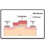 NAND flash
