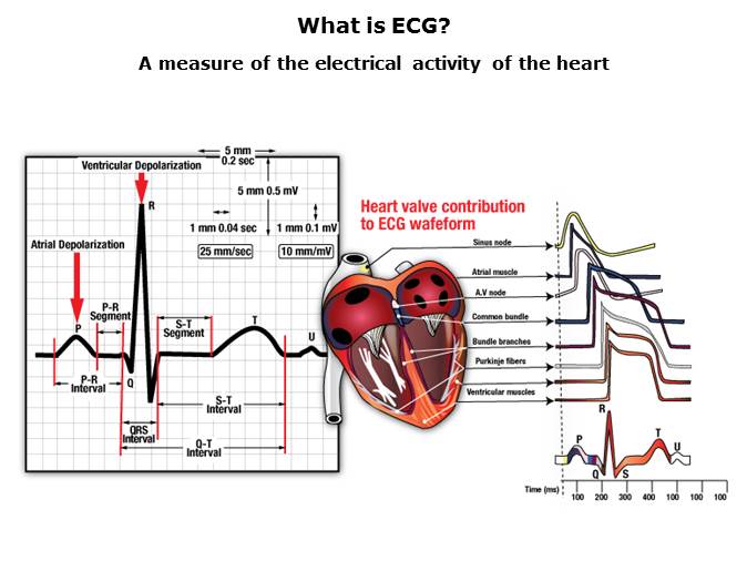 Medical ECG Slide 6