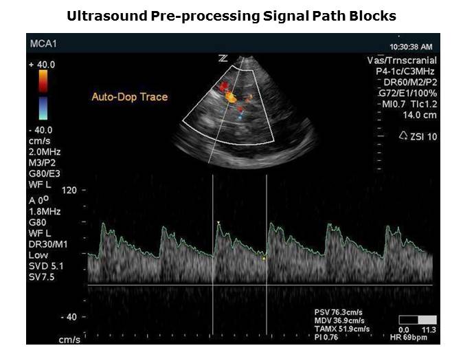 Semiconductors for Ultrasound Slide 15