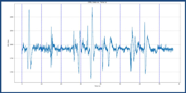 Image of Low-Cost, Power Efficient EMG Prosthetic Hand (Part 1)