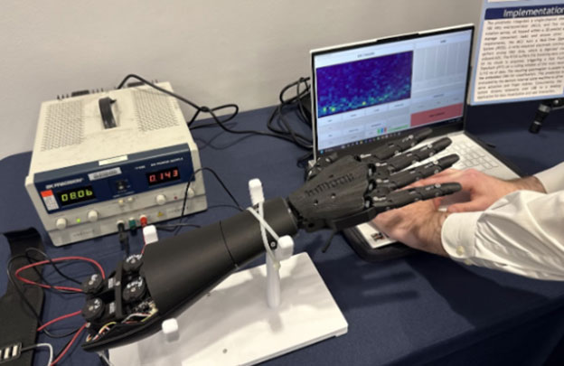 Image of Low-Cost, Power Efficient EMG Prosthetic Hand (Part 3)